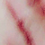 :icon918a: