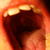 :iconahbarfilez: