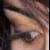 :iconakebia: