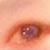 :iconalbinojamaican: