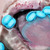 :iconambersome: