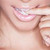 :iconamesiella:
