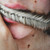 :iconan-ya: