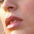 :iconanaklitos: