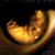 :iconAphelionic-Afekt: