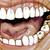 Armell :iconarmell: