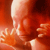 :iconartificialfetus: