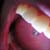 :iconBaronSuicide: