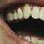 :iconberyll: