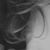 :iconbeti-beta2: