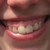 :iconbibiola: