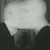 :iconbister: