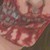 :iconblacksoulblood: