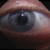 :iconblasterx: