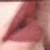 :iconbloody-kisses: