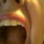 :iconbloodydisco: