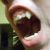 :iconbluntvayne: