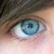 :iconblurringlight: