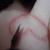 :iconbrittle-franknstein: