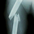 :iconbrokenarm: