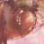 :iconbucikah-stuff: