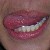 :iconburntbutt0ns: