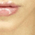 :iconbutterflyght: