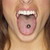 :iconchachy:
