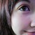 :iconchemicalblow:
