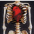 :iconchromatose: