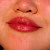 :iconcracklady: