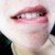 :iconcrazycrocodile: