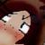 :iconcrimsonchan: