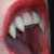 :iconcustomfangs: