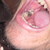 :icondamonbolt: