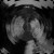 :icondancers-in-the-dark: