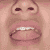 :icondarkfireeye: