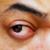 :icondeclic-832: