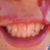 :icondickllikwid: