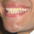 :icondiemanob: