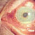 :iconeasyreeder:
