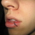:iconemrysangel:
