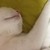 :iconencephaloma: