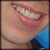 :iconenygmagen: