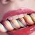:iconeuphoria007: