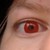 :iconferniferousfern: