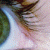 :iconflp-rch: