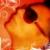 :iconfofinhopill: