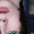 :iconforgottenx: