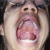 :iconfranksmoufplz: